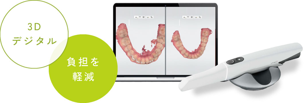 3Dデジタル・負担を軽減