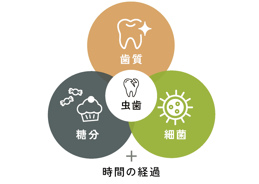 虫歯=歯質+糖分+細菌+時間の経過