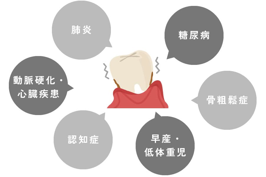 肺炎、糖尿病、骨粗鬆症、早産・低体重児出産、認知症、動脈硬化・心臓疾患